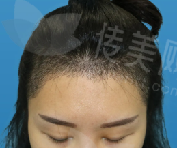q3r23.png