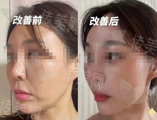 微信截图_20250205162251.png