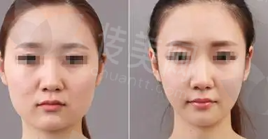全国.png