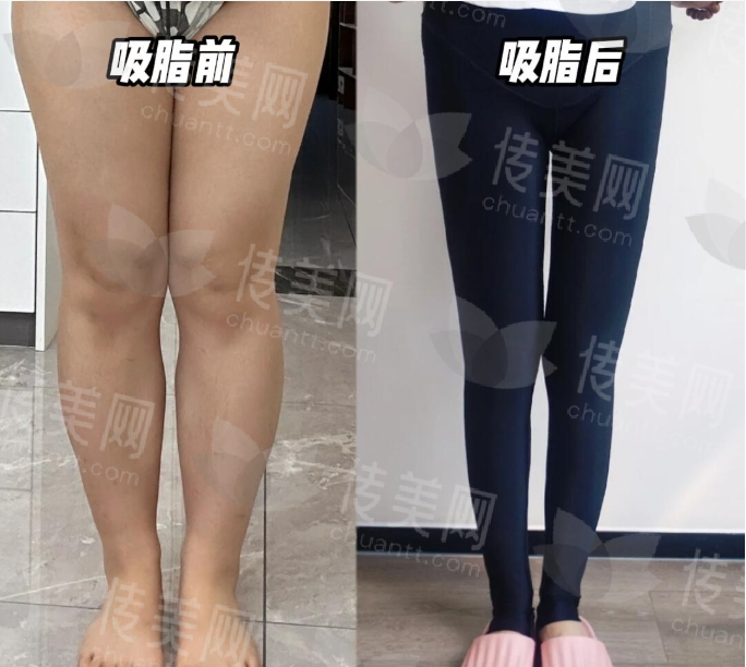 微信截图_20250207135339.png