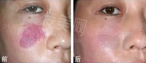 其二苟且.png