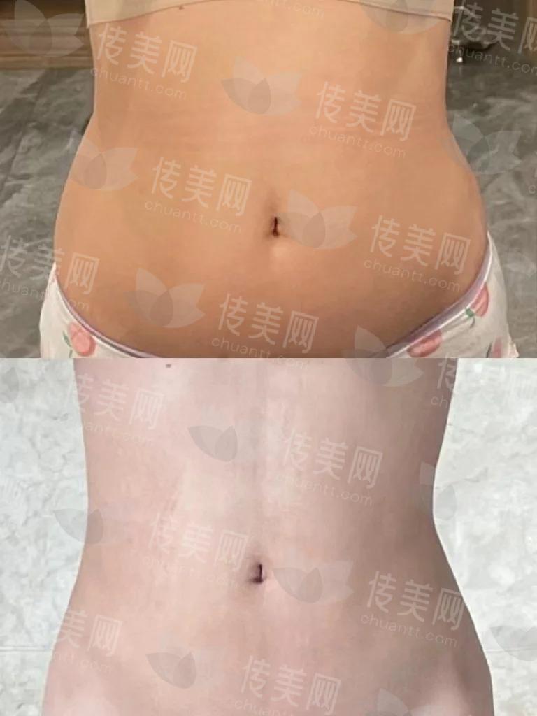 记不清是第几天了_1_小红薯66A84C96_来自小红书网页版.jpg