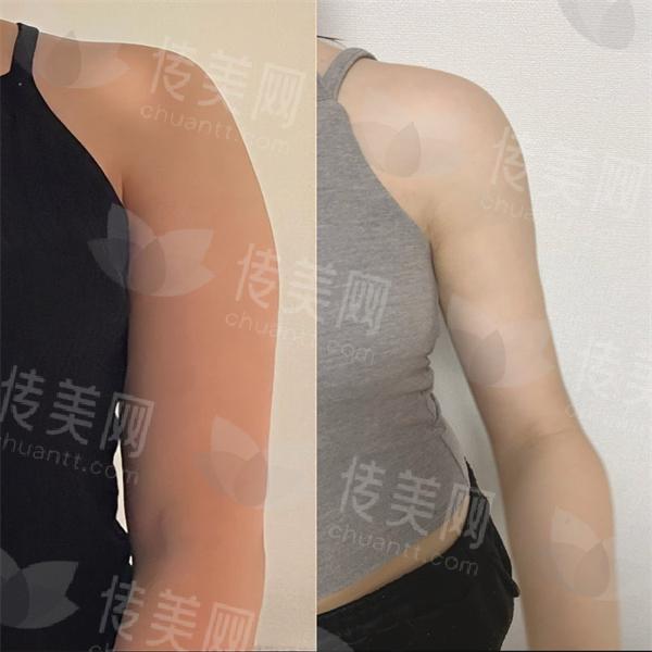 n3r5Sykm49C_upD-zSjIqDvyqzSchbJIcN8L86tpaYbajGjJU-ETY23rKmmsrDEj.jpg