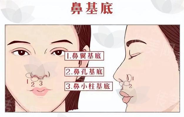 69d8841a448d4031b67bf17d579a2873.jpg