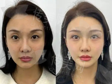 微信截图_20250228113327.png