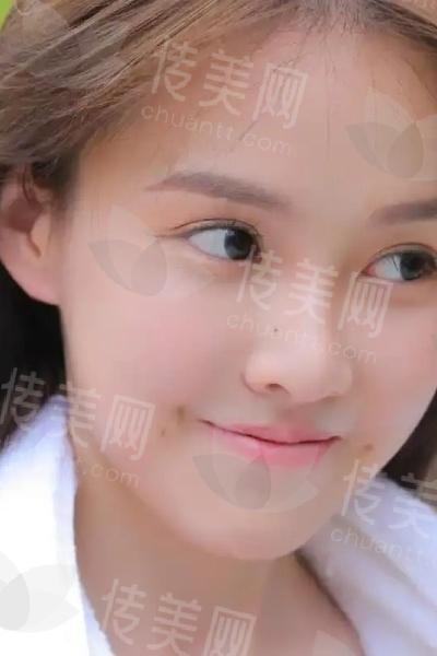 广州健丽做提眉术价格多少钱？