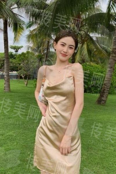 膨体垫下巴手术