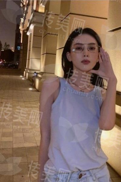 膨体垫下巴手术