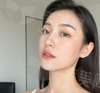 长沙艺脂整形李瑶隆鼻强调鼻部稳定性，维持持久效 果
