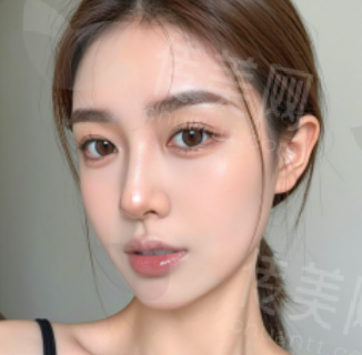 鸿瑞整形张辉鼻修复预约