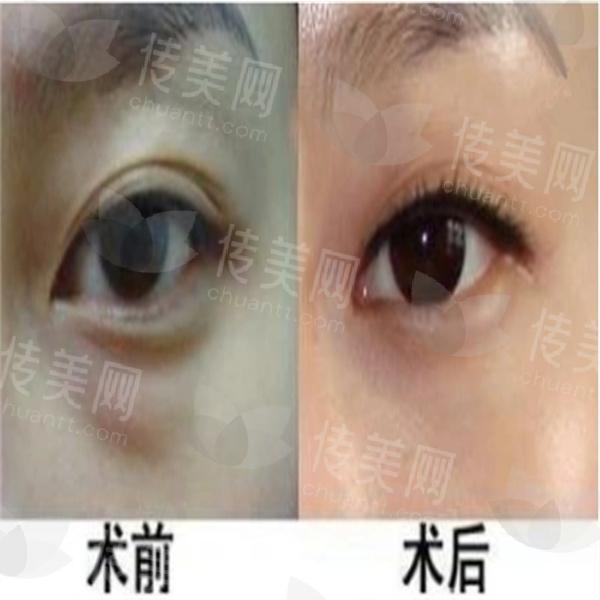u=2405525711,4122621086&fm=253&fmt=auto&app=138&f=PNG.jpg