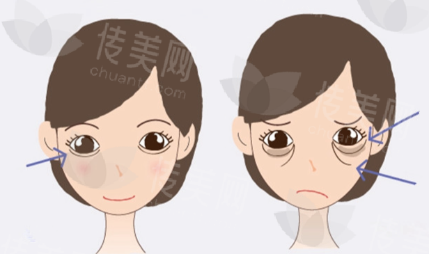 国内双眼皮修复手术医生排名
