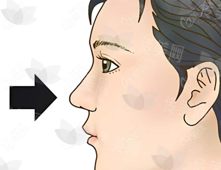 1fd971d816e7f7618d110e31a31bcb65.jpg