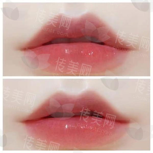u=1565006468,2603153236&fm=253&fmt=auto&app=120&f=JPEG.jpg