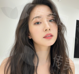 宜春名星（原华美）整形杨天明双眼皮修复优势