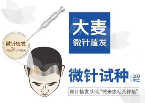 无锡大麦无痕植发简介