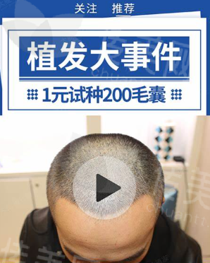 无锡大麦无痕植发简介