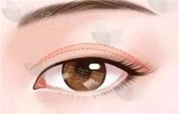 57acc0cf257f1a760984d5bd3138d5c4.jpg