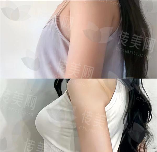 99b626cdly1hs6k0hisa3j20u013y451.jpg