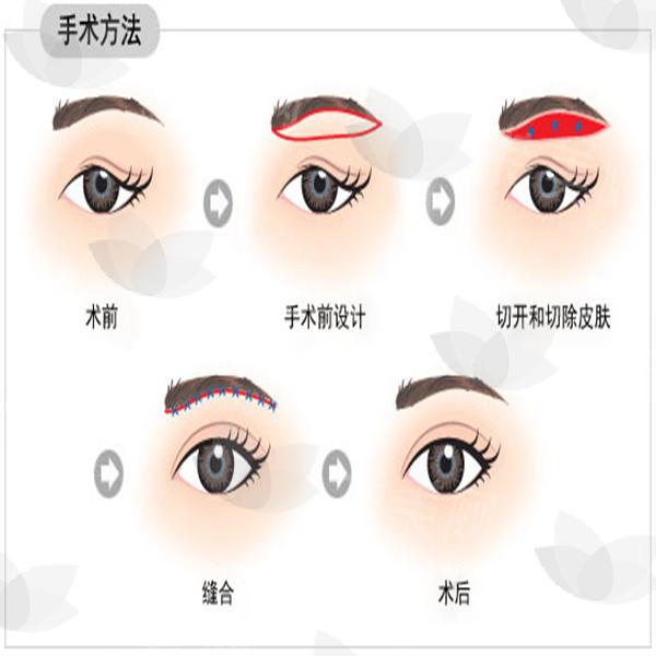 A956BD96DE331DB84CB5E74FFE<span style=