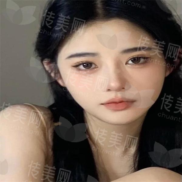 c995d143ad4bd113be4b8cc07fcc49064afb052e.jpg