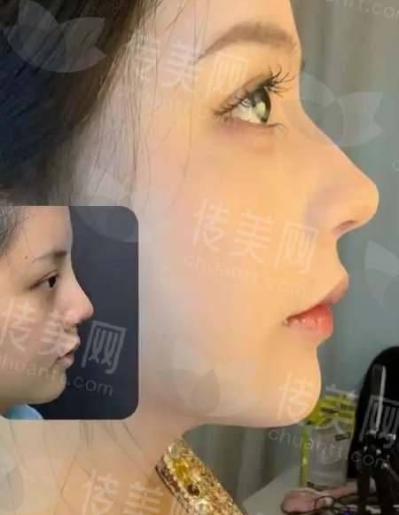 微信截图_20250416093820.png