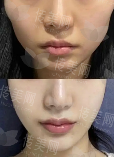 微信截图_20250418095100.png