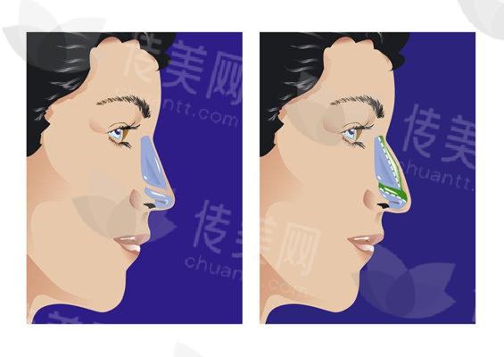 北京丽星翼美整形医院整体实力介绍