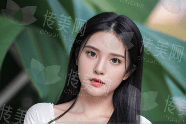 丽水心艺整形黄胜高医生双眼皮：自然、无痕、美观