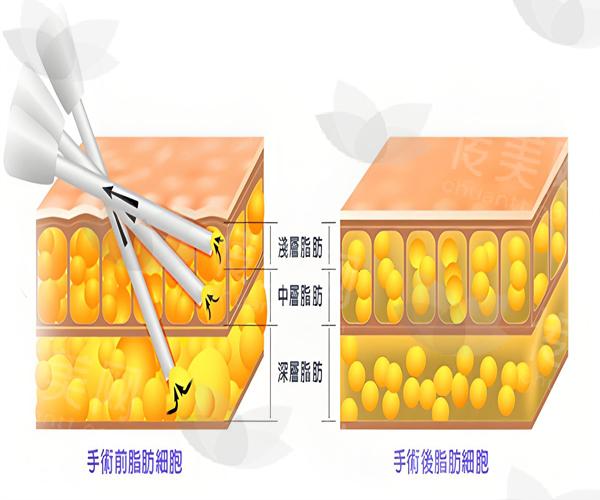 6f7737e56cc5e3a39234f70db8995c0b_副本.jpg