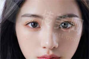 三、付国友经典手术