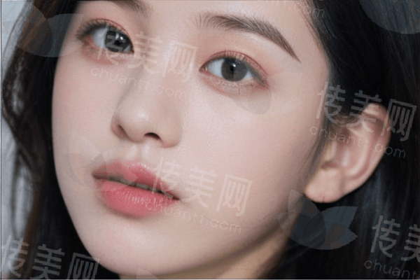 深圳艺星整形刘登涛祛疤敏痘：从“问题肌”到“素颜肌”