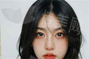 01. 大连未莱张丽院长主诊，技术专注吸脂＋填充＋整形线条设计