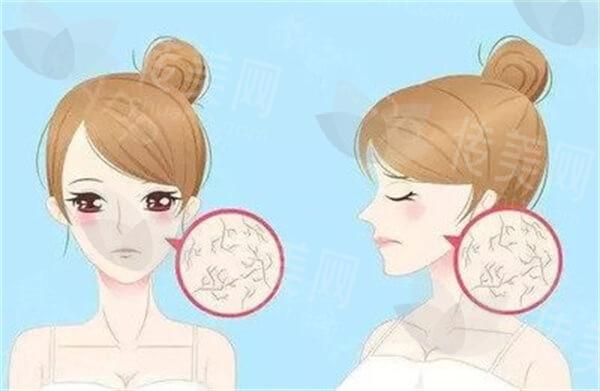 上海下颚内缩排名前8的医院汇总 告诉你哪里做下颚内缩技术更好！