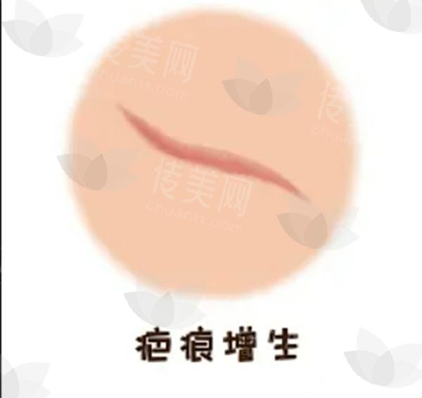 上海下颚内缩排名前8的医院汇总 告诉你哪里做下颚内缩技术更好！