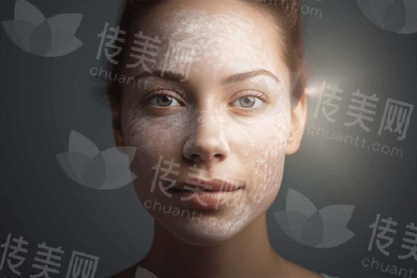 上海盈美整形口碑好吗 他家正规且性价比高