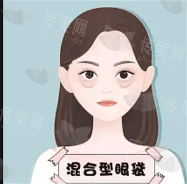 沈阳玻尿酸去黑眼圈哪家正规好一点？ 这里都是技术口碑好的医美医院