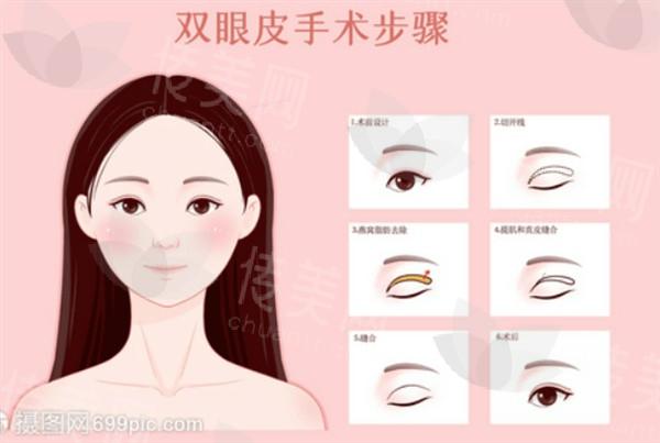 广州下颚内缩哪家医院好？ 排名里的天姿/臻妃/壹加壹值得去