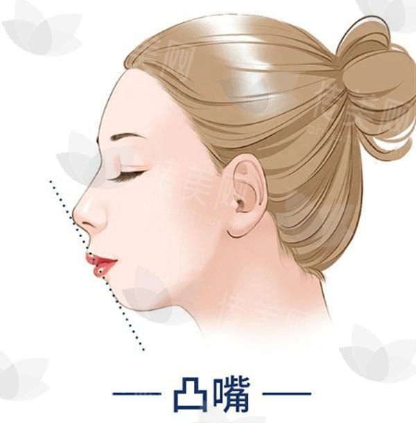 深圳千羽医疗美容医院口碑怎么样 网友评价赞爆了顺便送上价格