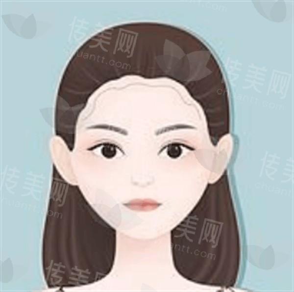 深圳丰唇哪家医院好价格还不贵 玺康技术靠谱性价比高