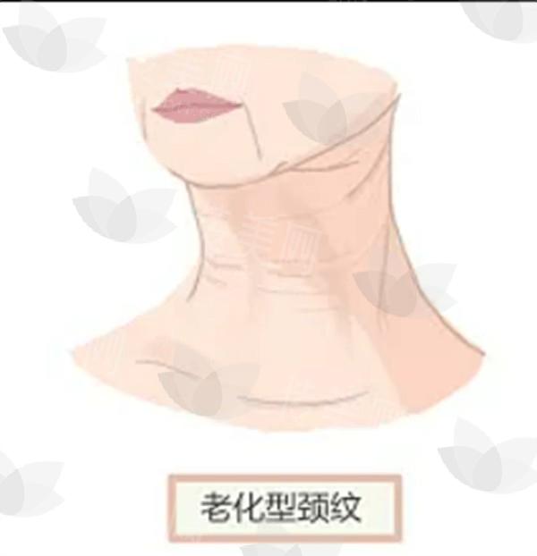 成都乳房再造哪家医院好价格还不贵 成都口碑