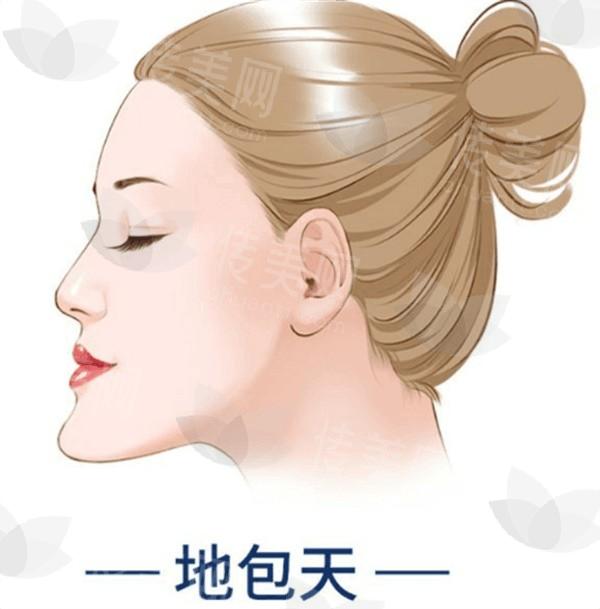 昆明鹰钩鼻矫正医院哪家好 这些是昆明有名且口碑好的医美医院