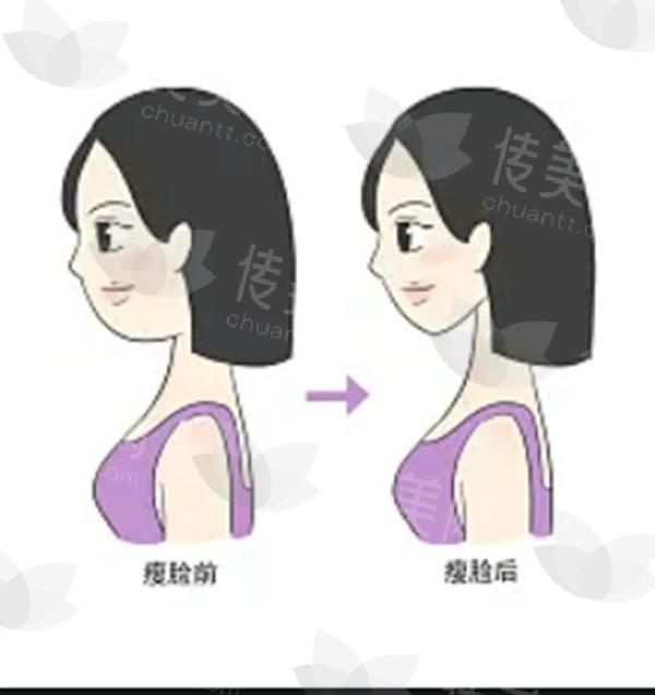 昆明梦想整形医院是不是正规的 实力证明不仅靠谱还便宜又好