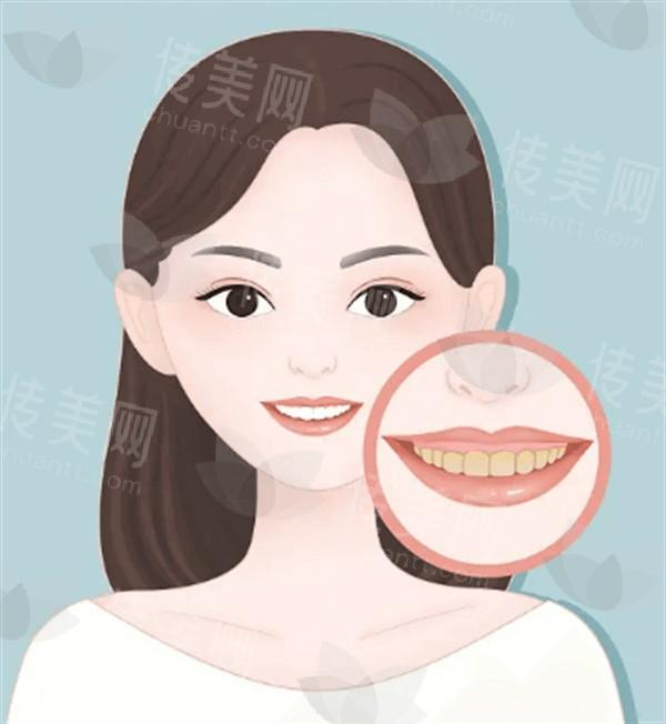 成都乳房下垂矫正比较好的医院 排名上韩妃/健丽/友谊医院挺出名