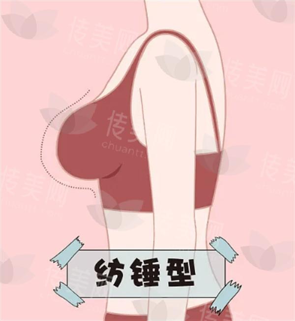 成都鼻翼缩小便宜又好的医院有哪些 成都鼻翼缩小性价比高的医院在此