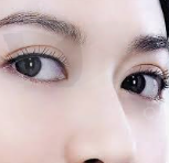 莆田割双眼皮医生推荐 莆田卓睿整形宋跃双眼皮技术怎么样?双眼皮价格2000元起,附医院/效果优势/地址