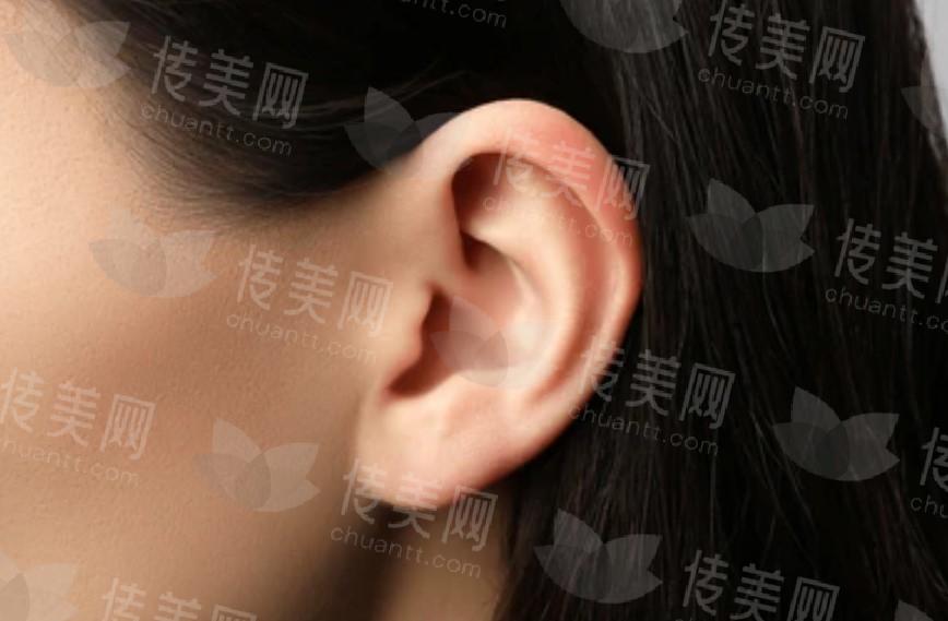 北京徐学东医生能做耳软骨隆鼻!医生技术好,做得鼻尖很翘,坐诊地市&预约链接来了
