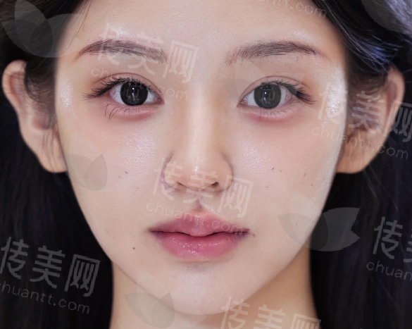 上海眼修复领域优秀医生盘点:杜园园/柴云/朱迪/徐晓斐等医生眼修复技术好,眼修复8000起