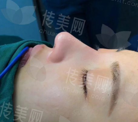 十大隆鼻专家名单排名介绍,鼻综合/鼻修复/鼻翼缩小/肋骨隆鼻项目都非常擅长
