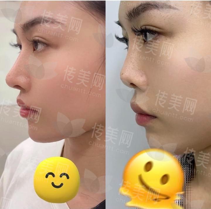 上海十大隆鼻整形医院推荐,专业塑美,焕新自信!